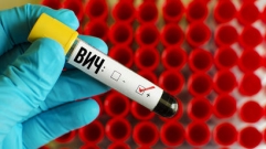 OSN s názvem Rusko epicentrem celosvětové epidemii HIV